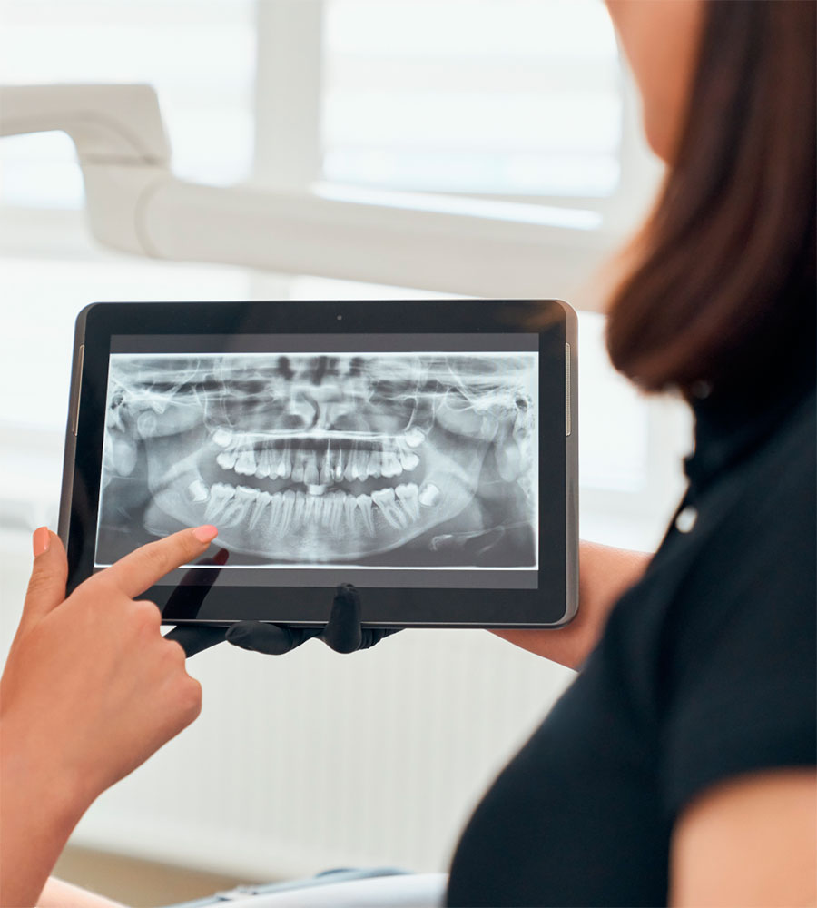 Raio-X Digital de Baixíssima Radiação Genoray