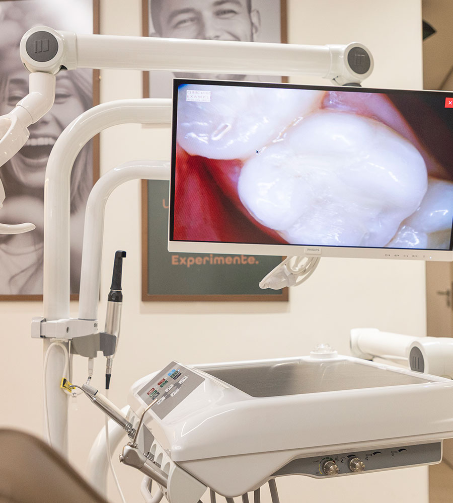 Scanner - Intraoral SKYcam